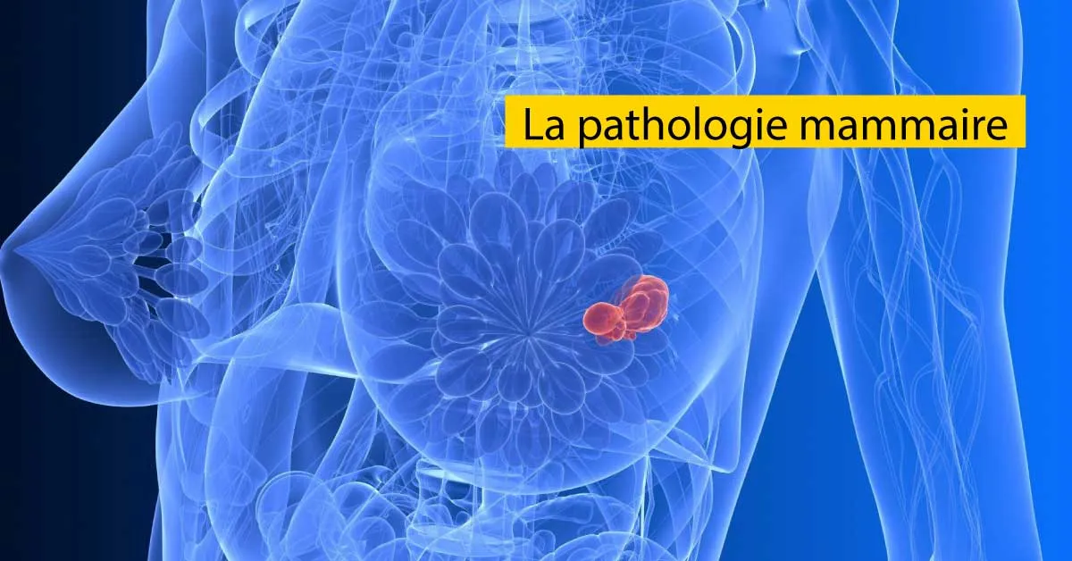 la pathologie mammaire